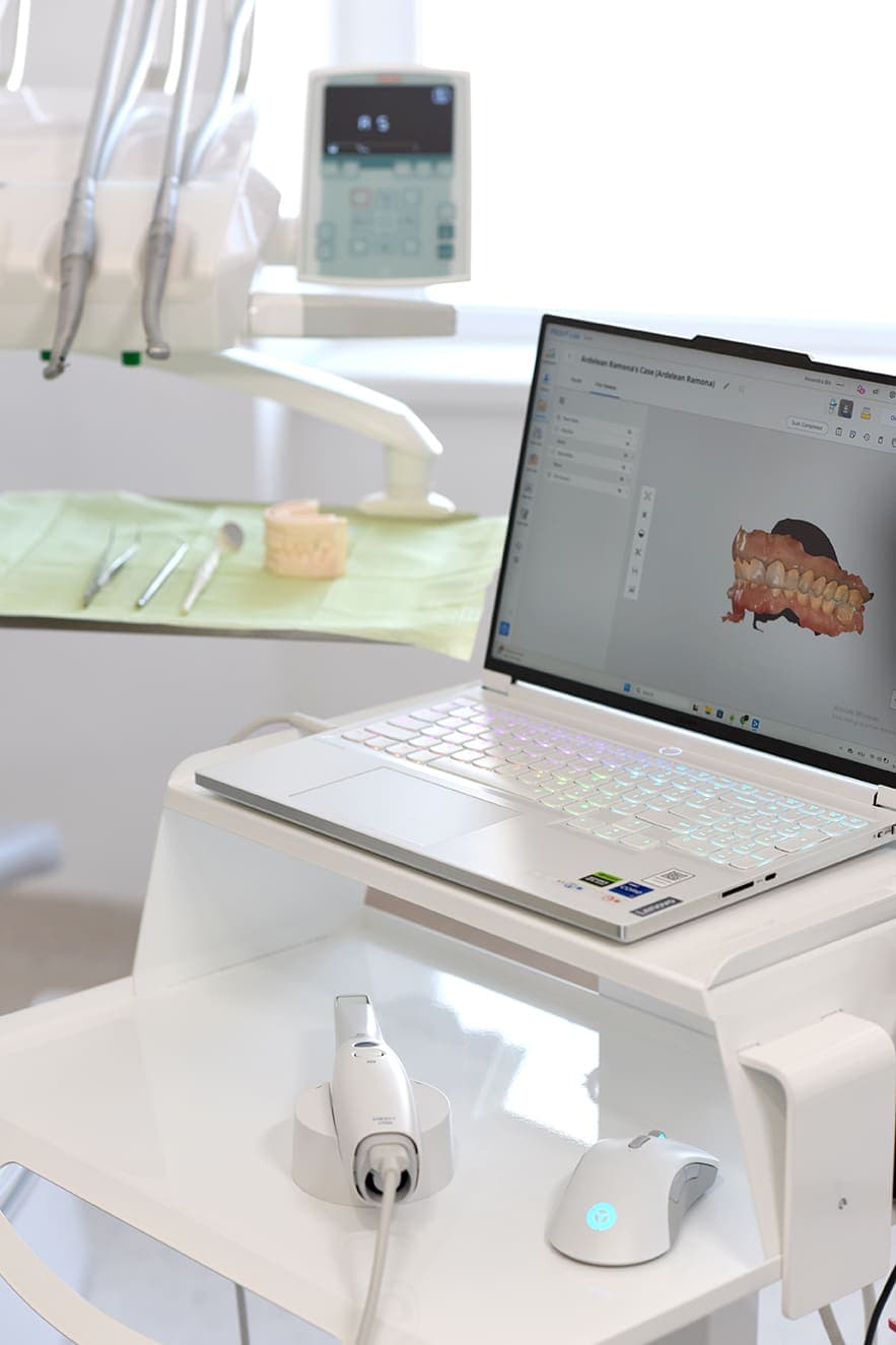 Scanare intraorală 3D afișată pe laptop, lângă scannerul intraoral pe unitul dentar